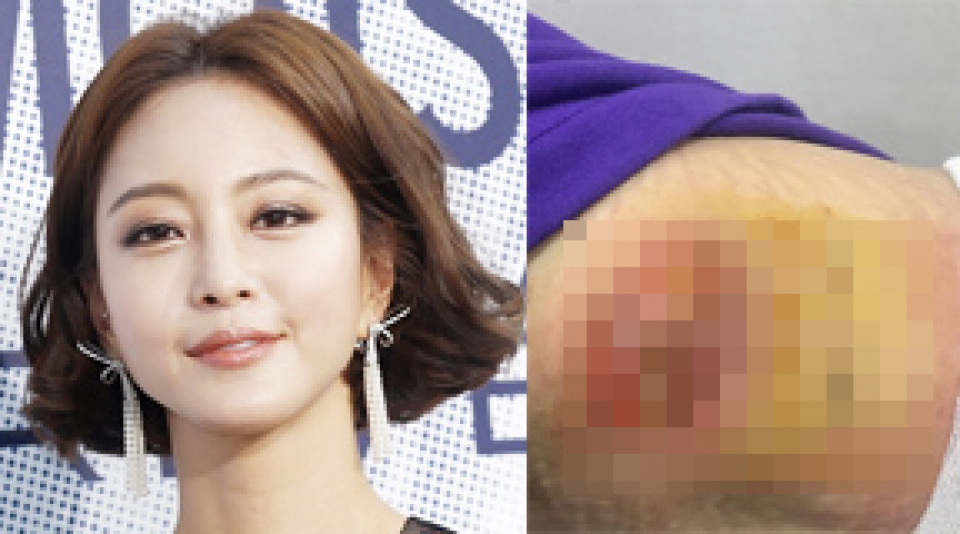 伴侶犬の転倒事故を知らせた俳優のハン·イェスルが、その後の進行状況を公開した。ハン·イェスルは19日、SNSに「レレが手術を無事終えて現在入院中」とし「CCTV確認の結果、私たちに渡される前に職員のミ- MK