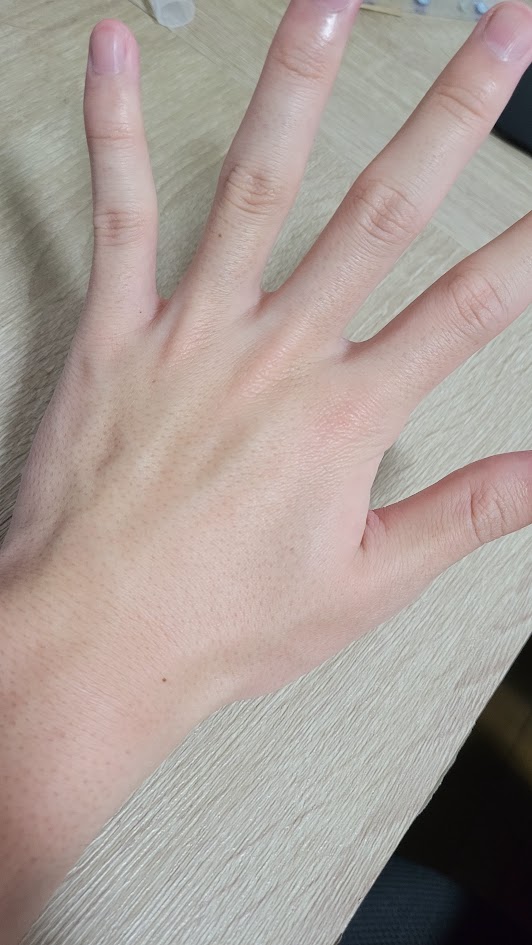 メンズ ひじ下+手の甲指 wax脱毛