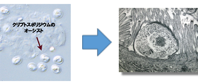 寄生虫についてもっと学ぶ。 - アンブロシア株式会社アレルギー検査キットアレル・チェックリーキーガット食物アレルギー遅延型フードアレルギー腸腸内環境自宅検査キットソーラーD日焼け止め