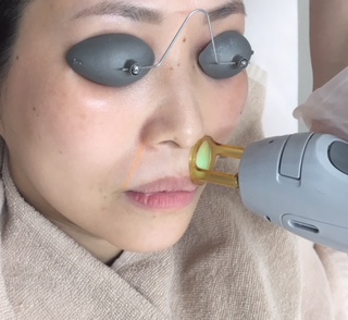 女性にもひげが生える？ひげの原因や対策、脱毛初心者が注意すべきポイントを解説！ - 銀座・名古屋・心斎橋の美肌治療は椿クリニック