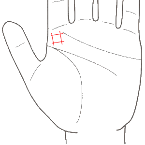 四角紋は周りの支えでトラブルや試練を乗り越えられるという幸運の証 運命線上に現れた四角紋は運命線の交差の角度や位置で発生するトラブルの時期や内容をある程度予測することができる運命線に重ならない場合紅琶菟羽98% くわっぱ