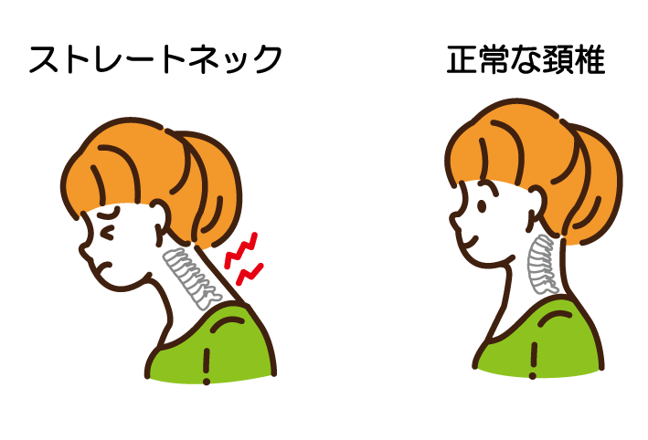 寝違えたらやってほしい3つのストレッチマッサージ・整体ファンにも大人気のRe.Ra.Ku グループ リラクグループ