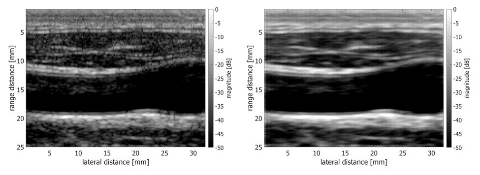 超音波検査」と「CT」、骨折時に使用されるのはどっち？│看護師ライフをもっとステキに ナースプラス