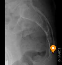 腰痛とは？その種類と原因、治療について天神橋筋六丁目 天六 駅の整形外科天6整形外科