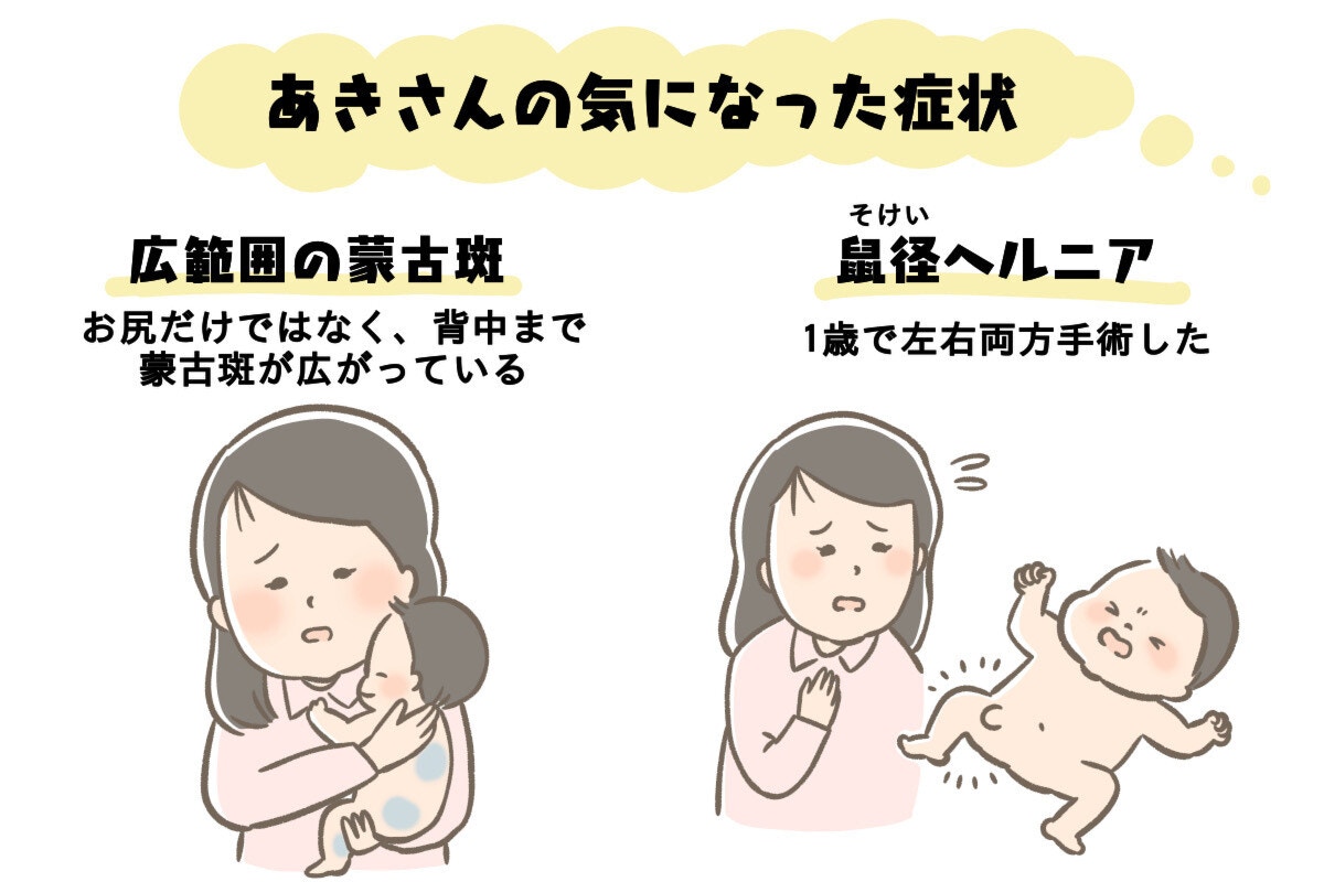 ドクターブログ おしりにあるもうこはん、消える？消えない？赤ちゃん・子供のあざ治療なら最新レーザー治療×形成外科専門医の大阪梅田形成クリニック