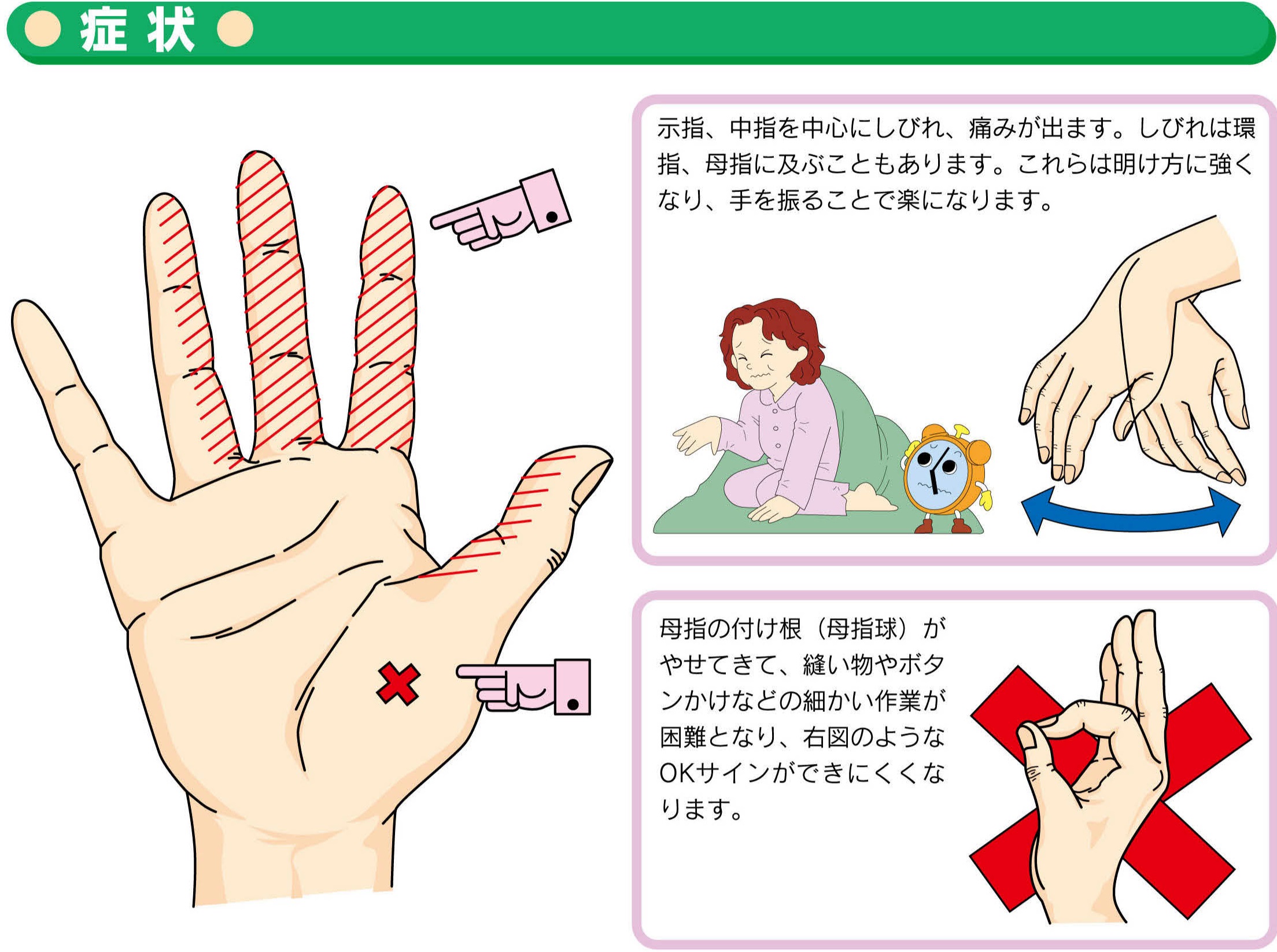 朝起きた時に片手がしびれる原因と対処方法を解説しますオーダーメイド枕の山田朱織枕研究所