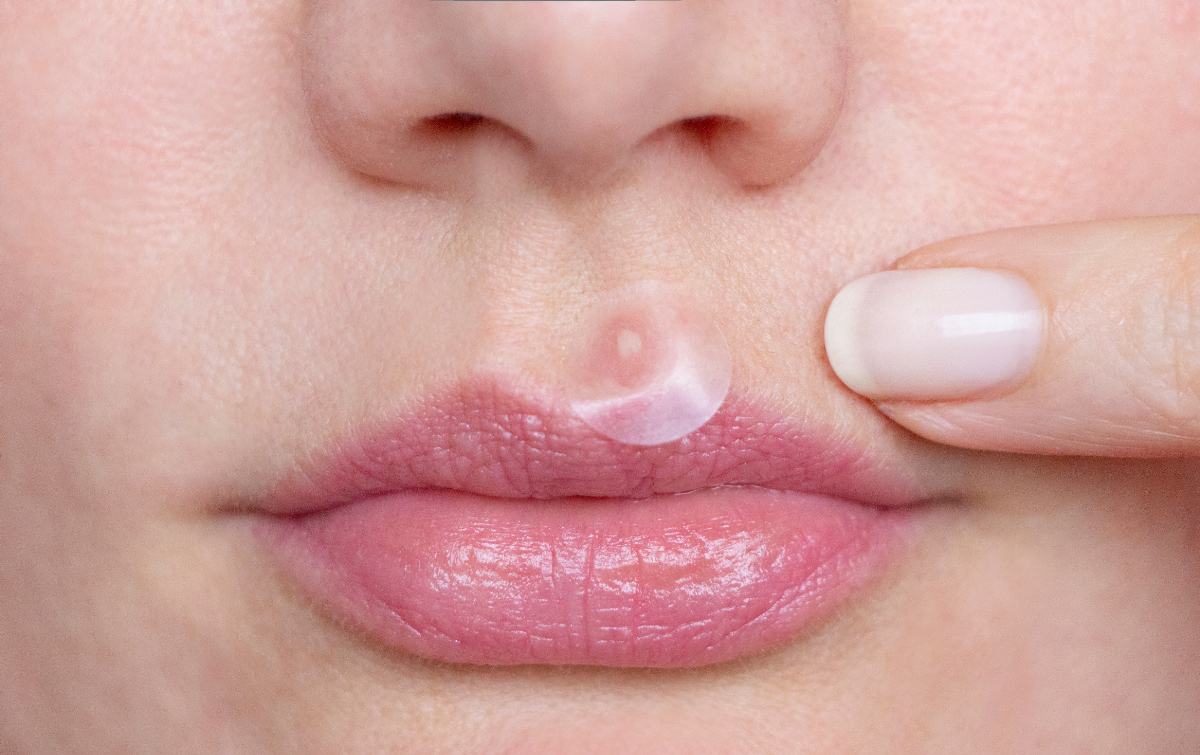 鼻の穴にできものができてます。鼻の整形 その他 鼻の整形の治療への不安 痛み・失敗・副作用