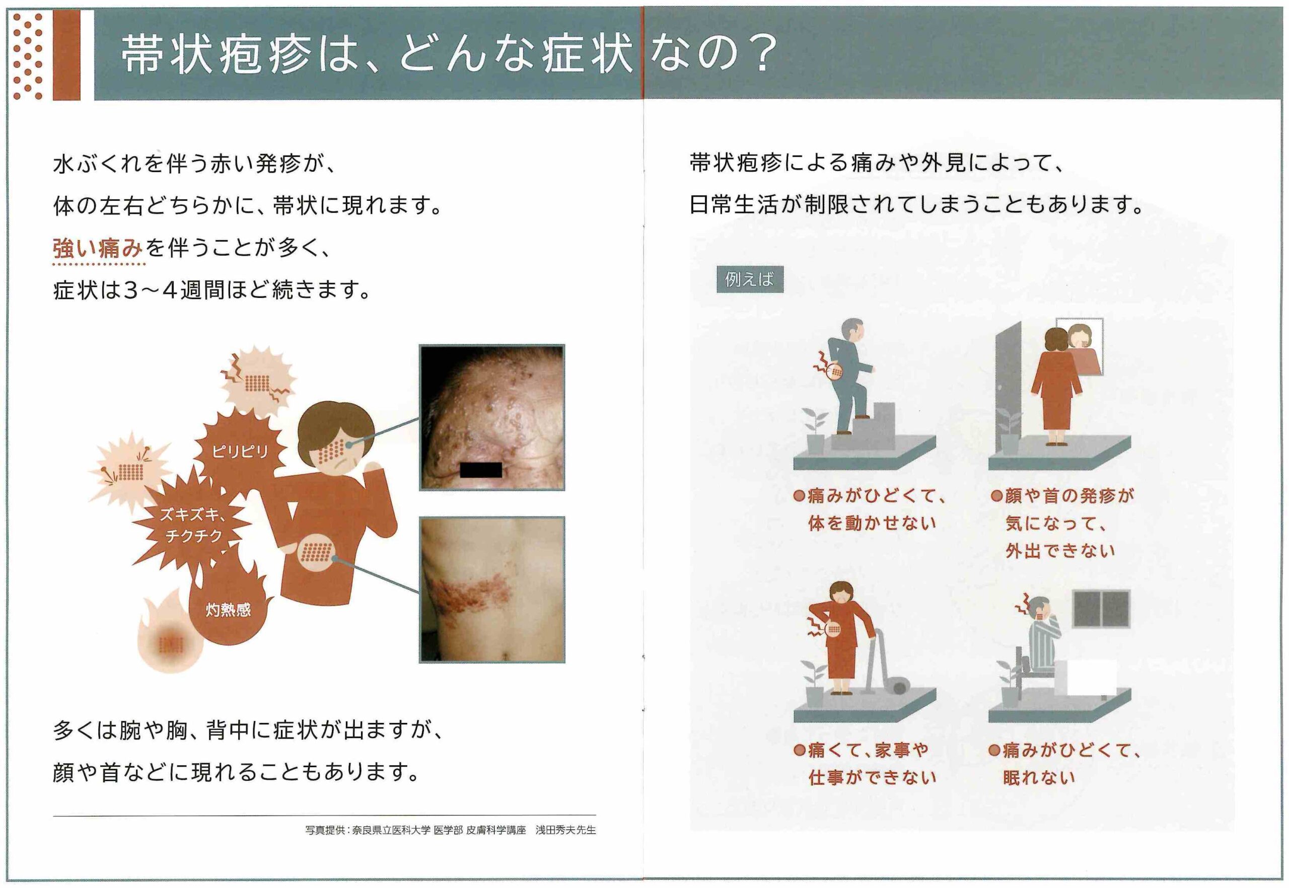 予防接種 インフルエンザ・帯状疱疹等春日駅前あべファミリークリニック内科 脳外科 整形外科 公式 文京区 後楽園駅1分