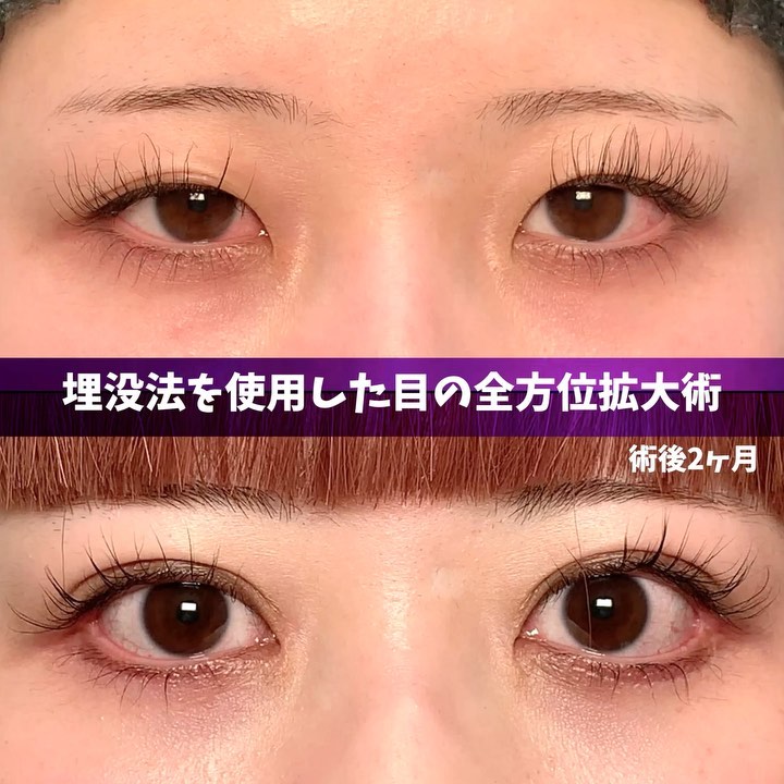 目の形別アイメイクのやり方 - Genspark