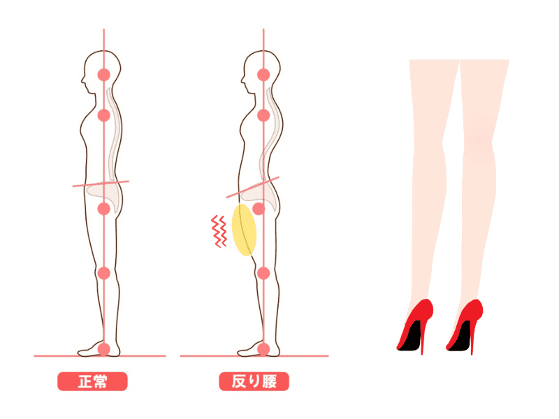 骨盤から重心位置を整えるだけで反り腰・反張膝は大きく変わる│カラダと姿勢・動きのトータルケアスタジオ カラダ DesignLab.®︎ カラダデザインラボ