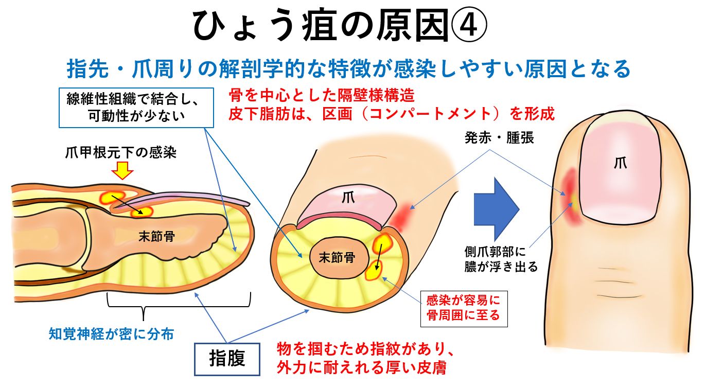 痔ろう あな痔 と肛門周囲膿瘍岡外科胃腸肛門科