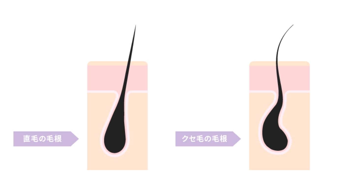 くせ毛を放置した男性は清潔感に欠ける⁈個性を生かしてイケメンに!RYOHEI KATO