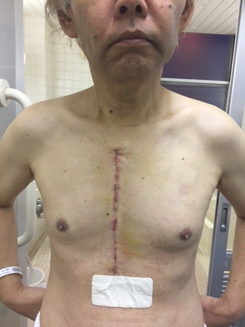 低侵襲心臓手術獨協医科大学 心臓・血管外科 Dokkyo Medical University Cardiac and vascularsurgery