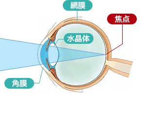 乱視」の原因・症状・対処法ロート製薬: 商品情報サイト