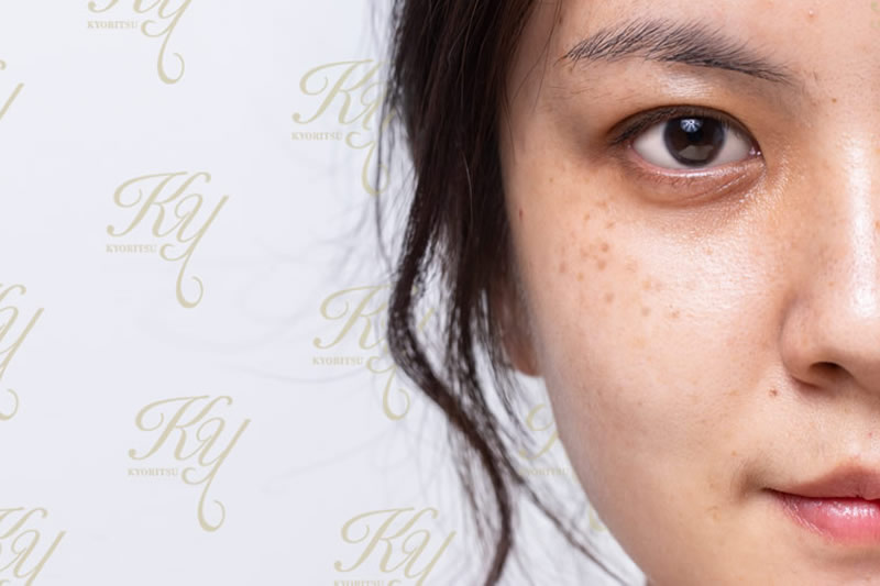 40代でシミがない人の特徴は？40代でシミができやすい原因と違いを美容皮膚科医が解説！恵比寿駅徒歩1分の美容皮膚科ATELIERMedical Clinic アトリエメディカルクリニック