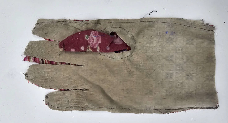 お尻から侵入して全身の皮下をうごめく大量の寄生線虫」が報告される - GIGAZINE