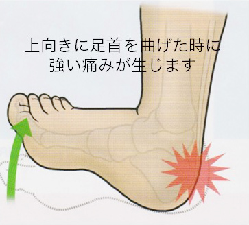 痛風について - 岐阜市 - 森整形外科リハビリクリニック