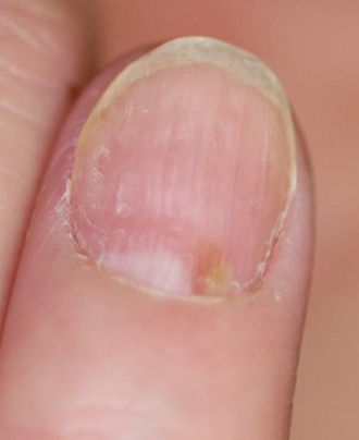 さて診断は？シャルムクリニックBlog