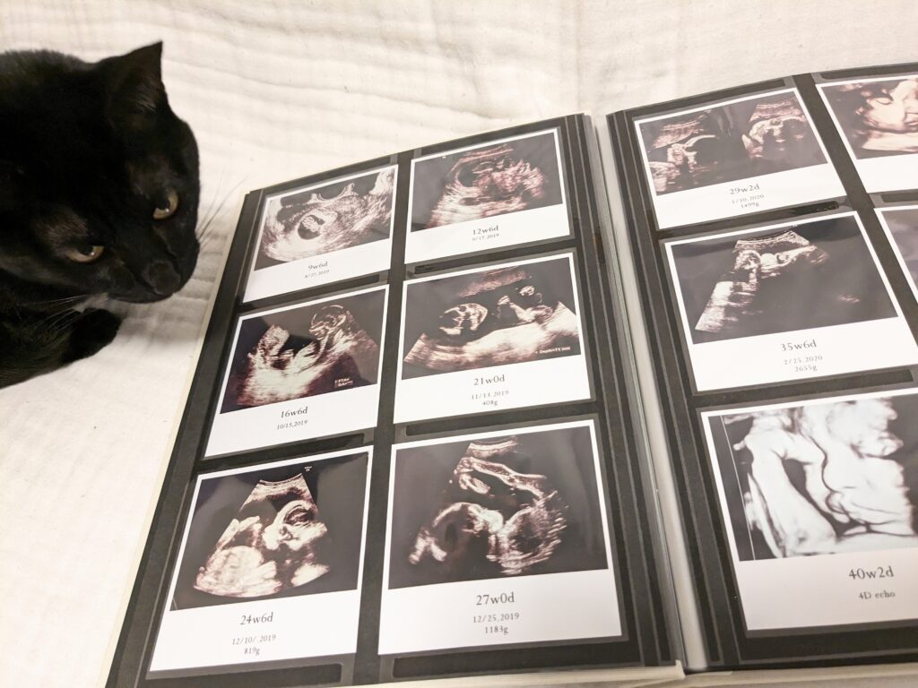 エコー写真の保存に便利なアプリ3選！消えてしまう前に大切に保管♪ワタシト