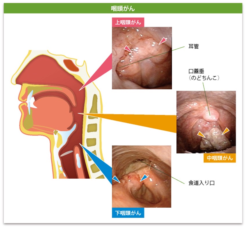 鼻の中が腫れていて赤い・痛い！できものに使える市販薬 9選！ 医師解説– EPARKくすりの窓口コラムヘルスケア情報