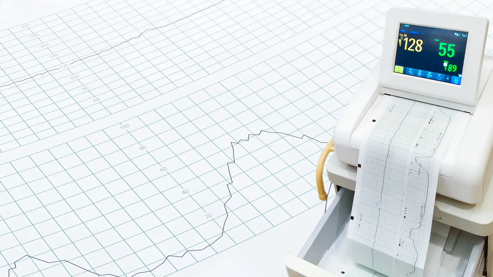 アメリカ妊婦検診NST ノンストレステスト あさこ駐在帯同2年目