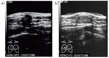 知っておきたい乳がん検査 3 CT検査やMRI検査、骨シンチグラフィ、PET検査、腫瘍マーカーメディアスホールディングス株式会社