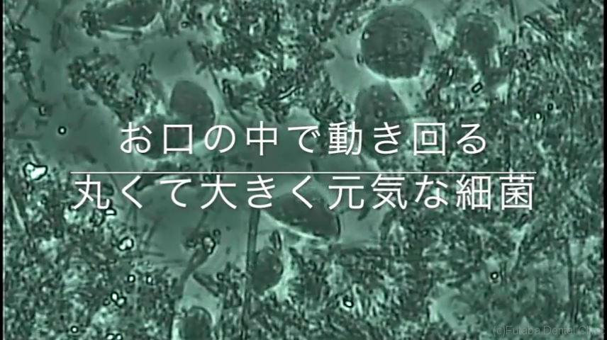 なぜ口の中に細菌がいるのか - プラザ若葉歯科ブログ