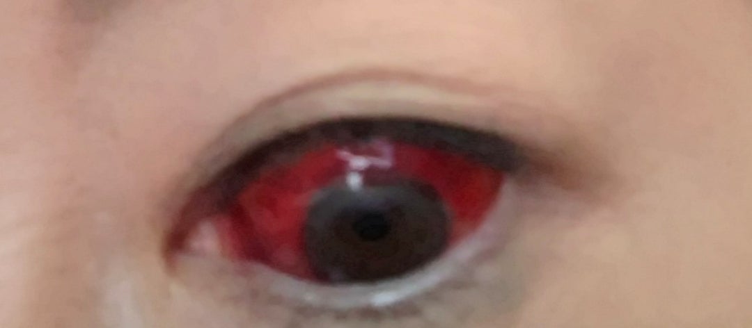 加藤眼科┃目の病気について