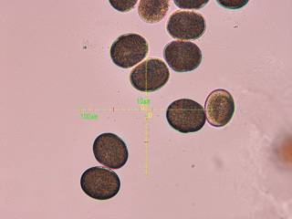 スギの花粉 顕微鏡倍率 ×800 32217000140 の写真・イラスト素材アマナイメージズ