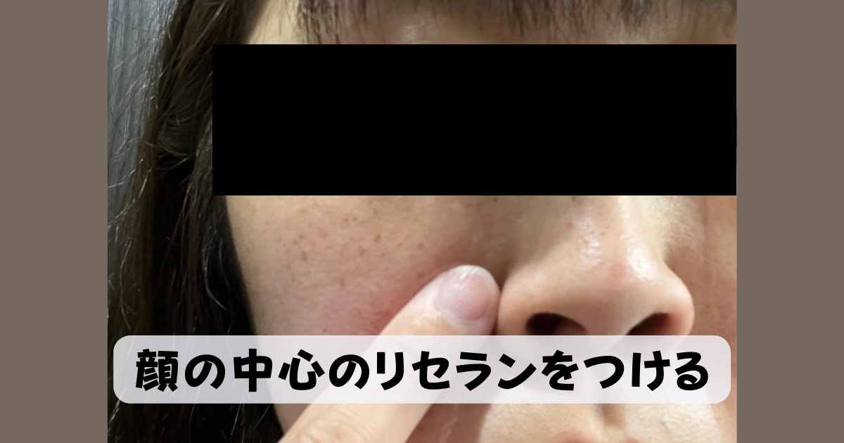肌ハリ効果なし？ クロノセルを使ってみた私の口コミ体験談！ 株式会社ゼンツ美容ブログ