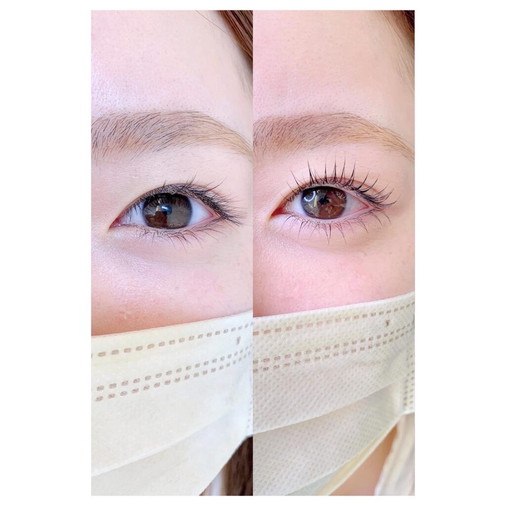 上下韓国アイドル風パーマ🎀 縦幅も横幅もぱっちり大きく見えます👼🏼 中顔面短縮効果も◎ ご予約はnet dmから可能です❣️ 上下まつげパーマまつげパーマデザインまつげエクステまつげパーマ束感まつげ束感まつげパーマ韓国風まつ毛パーマラッシュ