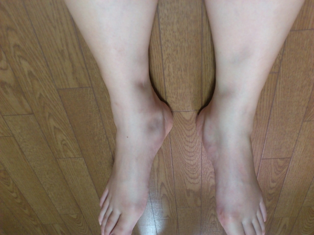 助産師が解説 妊娠中のむくみはいつから？原因や対策、効果的なマッサージ方法助産院きみおもい