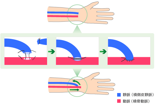 静脈系Hanalima 〜ハンドメイド教材の部屋
