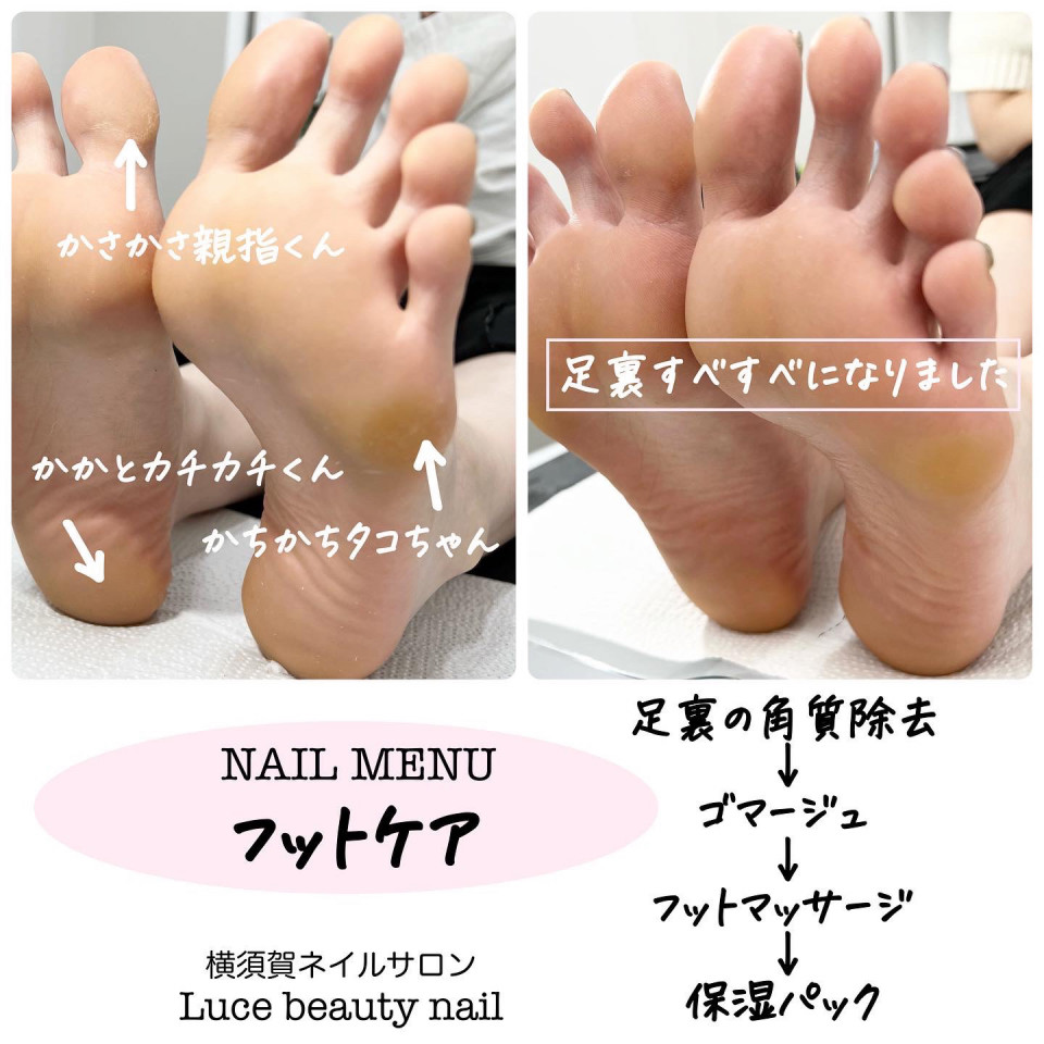 フットオイルマッサージ 1時間 まるで加工の様なビフォーアフター😳 2週間に1回必ず通っていただいているお客様😌今回は初めて1時間のコースに挑戦！ 定期的に通って頂いているのと、ご自身で毎日マッサージもしているのもあり、どんどん老廃物が流れやすくなっています