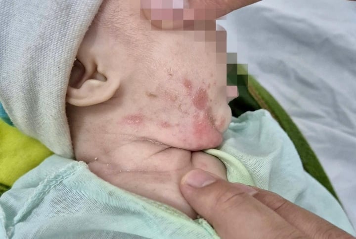 これって、性感染症？HIV検査・相談マップ