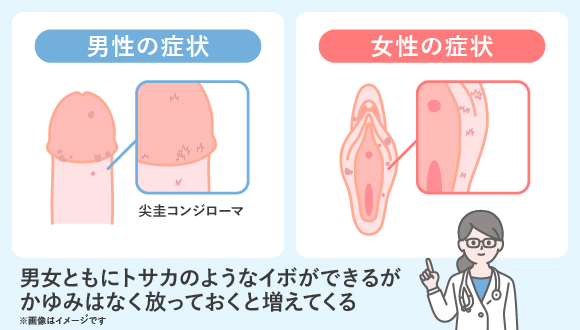 尖圭コンジローマの検査と治療 男女別症状や感染経路、感染率は？ 天神マイケアクリニック