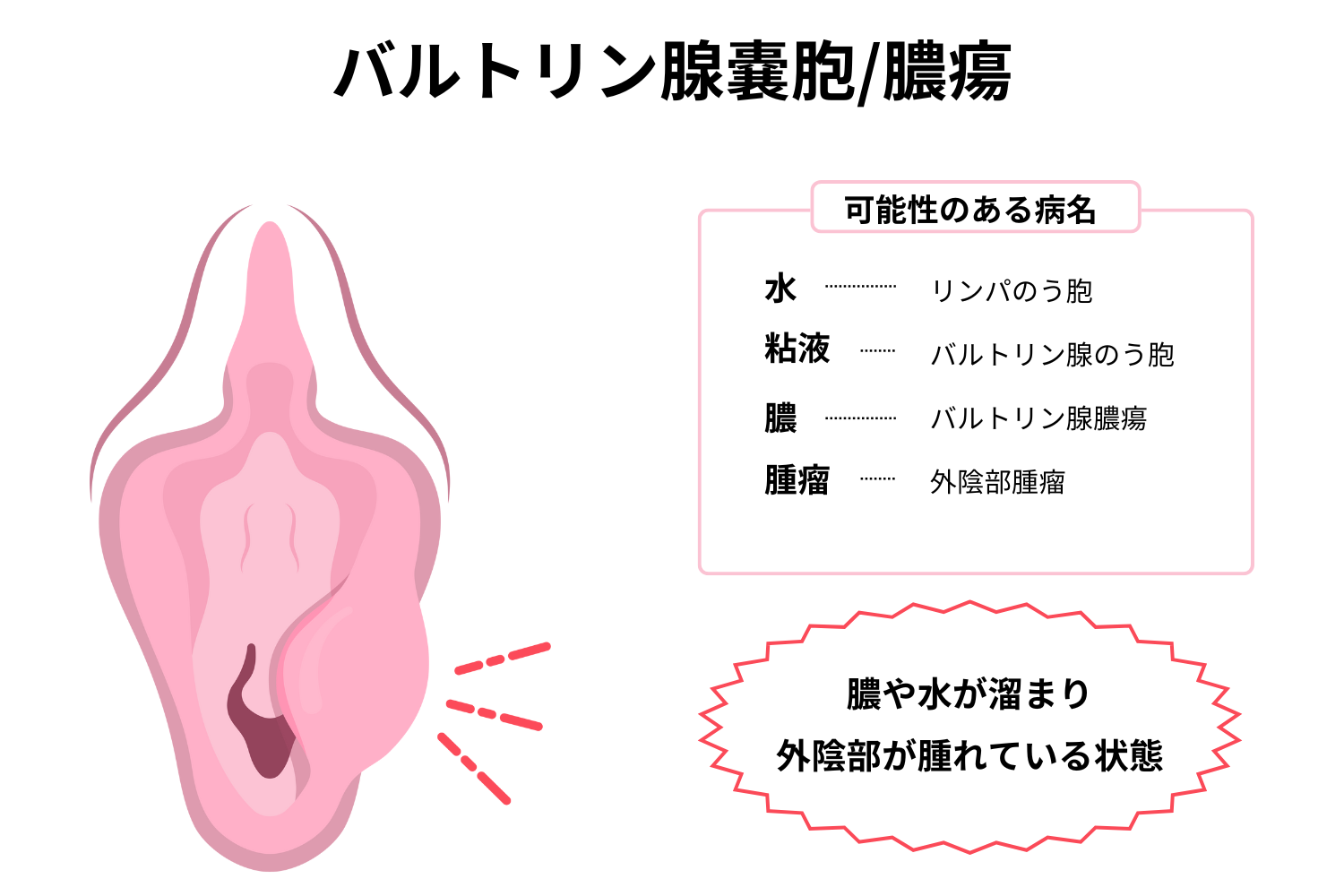 女性器のトラブルゆかりレディースクリニック 神戸市三宮にある婦人科