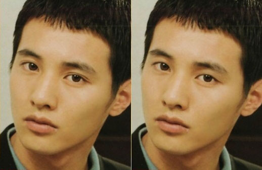 一重と二重の違いを徹底解説！構造・割合・遺伝性の高さ・メリット埼玉川口のフェアクリニック