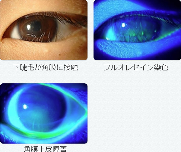 このような重たいまぶたでまつ毛が埋もれて見えません。またこのまぶただ- Yahoo!知恵袋