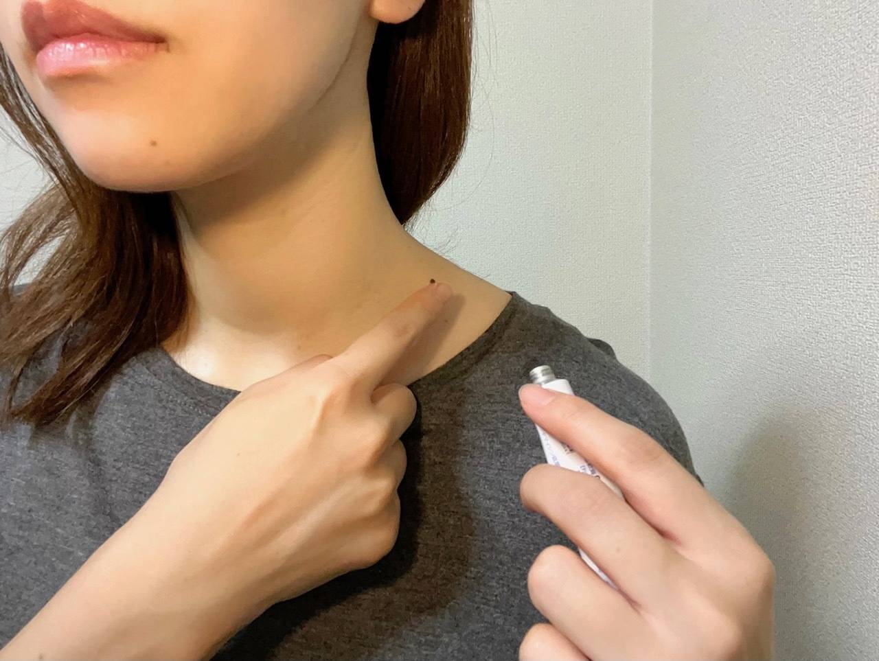 顔にできるいぼを除去するには？原因や治療方法を解説 - 上野御徒町ファラド皮膚科