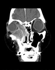 鼻の中のできものが痛い」時の対処法はご存知ですか？医師が徹底解説！ 症状の原因・病気一覧・診療科 - メディカルドック