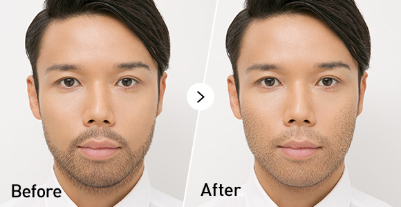 髭脱毛2年コース結果