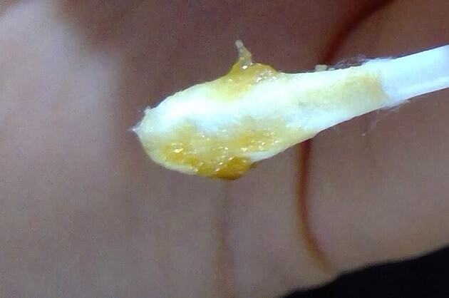 この画像を見てほしいです。軽度のワキガでもTシャツが黄ばむことはあります- Yahoo!知恵袋