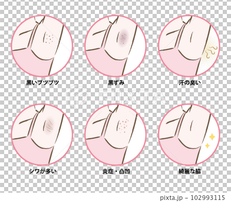 すそわきがだとどんな臭いがする？スキンケア大学
