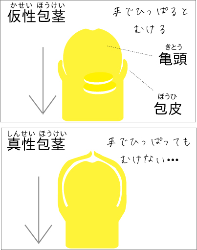 勃起力チェック】フル勃起時の角度や硬さ、持続時間からED診断｜薬の通販オンライン