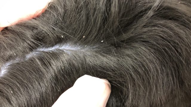 犬の寄生虫について知っておきたいこと：種類・症状・対処法ぽちたま薬局スタッフブログ