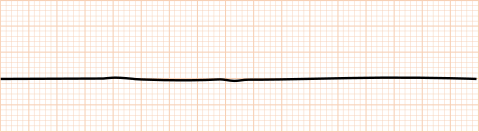 心電図 フラットデザイン カラーイラスト アイコン フリー素材 – アイコン・イラストダウンロードサイト OWL STOCK -オウルストック