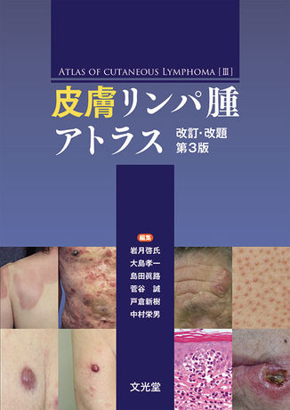 体にこんな「しこり」があったら絶対見逃さないで！悪性リンパ腫は「寝汗」でわかる？日本で一番多い血液がんの正体とは。初期の危険サインとは？医師が徹底解説
