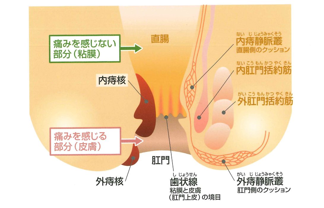 お尻の穴 肛門 のかゆみ原因・治し方・対処法・予防法大正健康ナビ大正製薬