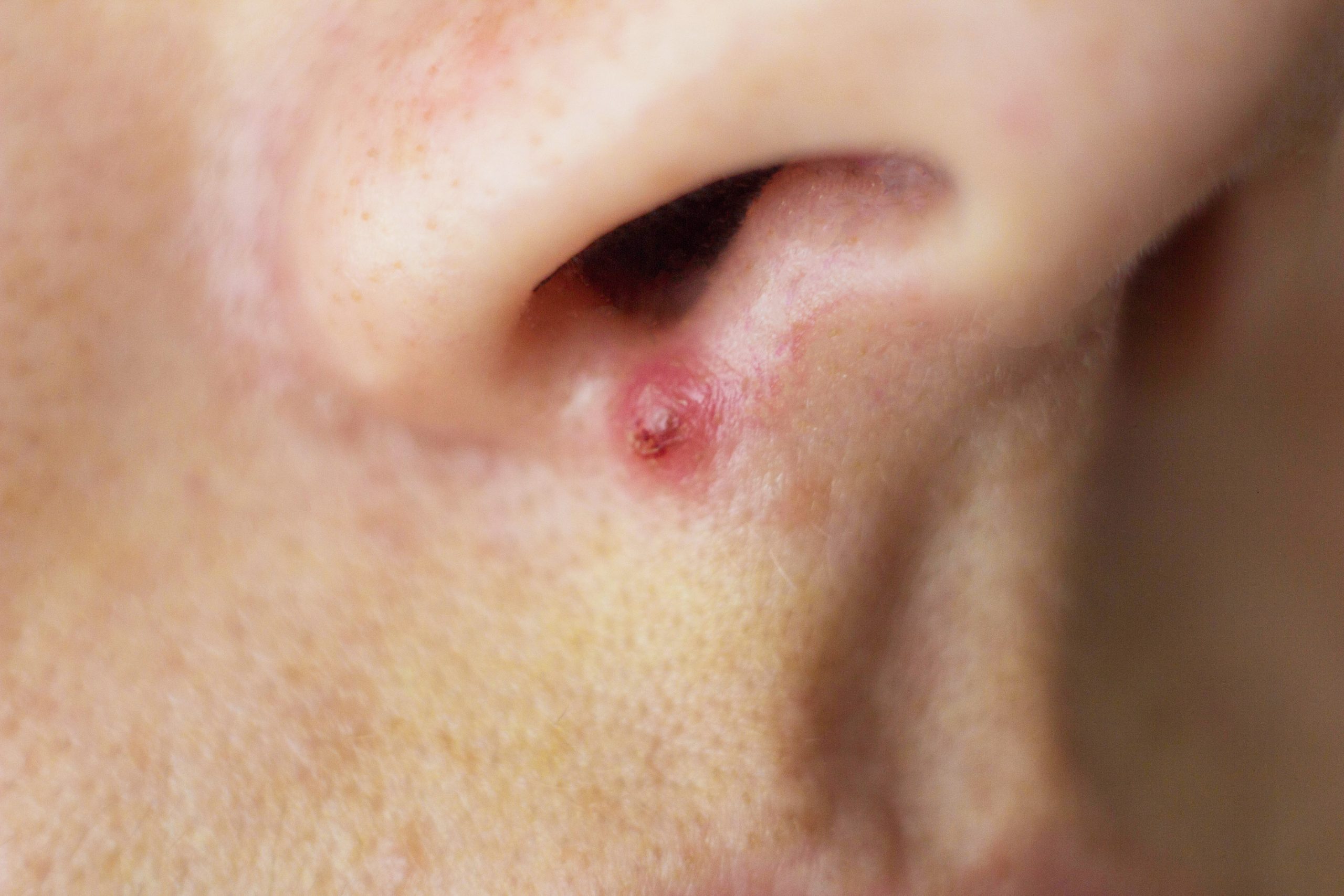 花粉症写真で見る「子どもの病気」 - みやけ内科・循環器科 総合内科のアプローチ